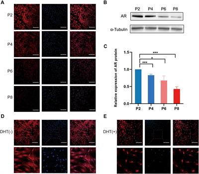 Transcriptome Analysis Reveals an Inhibitory Effect of Dihydrotestosterone-Treated 2D- and 3D-Cultured Dermal Papilla Cells on Hair Follicle Growth